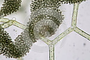 Freshwater algae Hydrodictyon reticulatum and group of cyanobacteria. Super Macro. Aquaculture