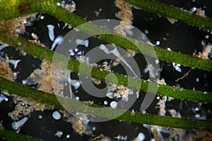 Freshwater algae watermilfoil Myriophyllum by microscope. Ciliates infusoria Stentor polymorphic protozoa microorganisms