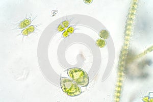 Freshwater aquatic plankton under microscope view photo