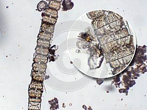 Freshwater aquatic zooplankton and algae under microscope view