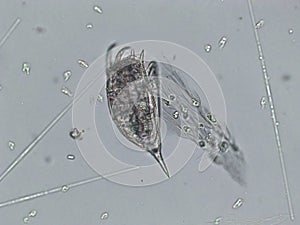 Freshwater aquatic zooplankton and algae under microscope view