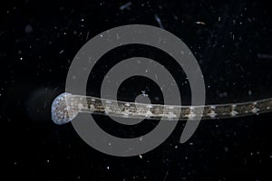 Freshwater leech Piscicola geometra by microscope. Rear end. Parasite, disease of fish