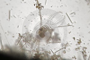 Freshwater rotifer or rotatoria Stephanoceros fimbriatus among phytoplankton