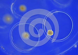 Freshwater snail eggs