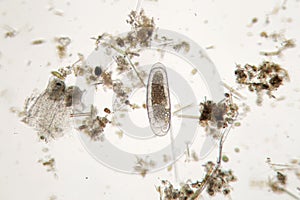 Freshwater unicellular microorganism. Zooplankton Super Macro photo
