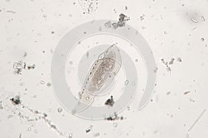Freshwater zooplankton probably protozoan ciliated Ciliophora photo