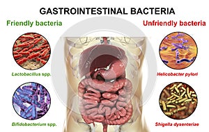 Friendly and unfriendly gastrointestinal bacteria photo