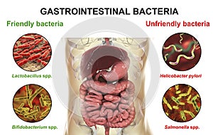 Friendly and unfriendly gastrointestinal bacteria photo