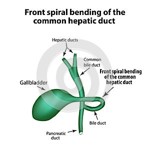 Front spiral bending of the common hepatic duct. Pathology of the gallbladder.