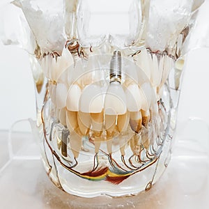 Front view mouth model