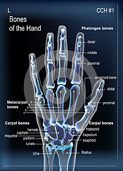 Frontal view x ray of bones the of hand with anotations.