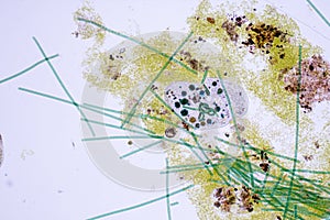 Frontonia sp. unicellular ciliate protists under the microscope.