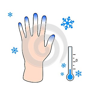 Frostbite. Hand with frostbite symptoms. effect of cold on human fingers. Vector