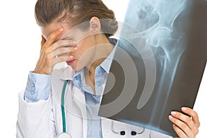 Frustrated doctor woman holding fluorography photo