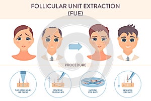 FUE hair transplantation procedure medical infographic poster