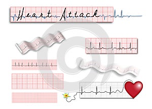 Full page EKG strips with Heart Attack title photo