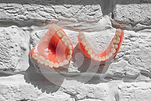 Full removable plastic denture of the jaws. A set of dentures on a light background. Two acrylic dentures.