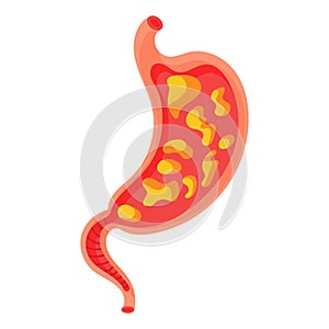 Full stomach. Heaviness of stomach, bloating, pain in the alimentary tract and acid heartburn. Duodenal problems and human organ photo