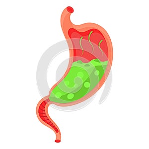 Full stomach. Heaviness of stomach, bloating, pain in the alimentary tract and acid heartburn. Duodenal problems and human organ photo