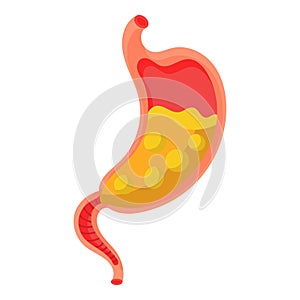 Full stomach. Heaviness of stomach, bloating, pain in the alimentary tract and acid heartburn. Duodenal problems and human organ photo