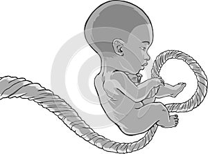 Fully grown baby (unisex), umbilical cord attached.