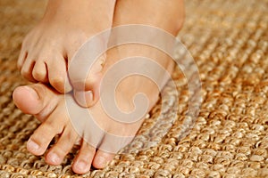 Fungal foot itching caused by biting feet