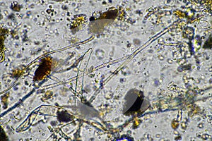 fungal hyphae and soil fungi in a soil sample, showing the living soil