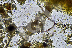 fungal hyphae on a soil sample on a farm. fungi storing carbon in the soil