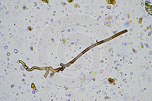 fungal hyphae on a soil sample on a farm. fungi storing carbon in the soil