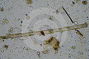 fungal hyphae on a soil sample on a farm. fungi storing carbon in the soil