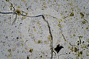 fungal hyphae on a soil sample on a farm. fungi storing carbon in the soil