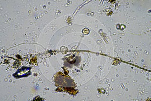 fungal hyphae on a soil sample on a farm. fungi storing carbon in the soil