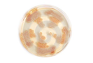 Fungi on agar plate in laboratory