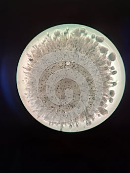 Fungi and bacteria under the microscope