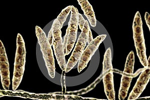 Fungi Fusarium which produce mycotoxins