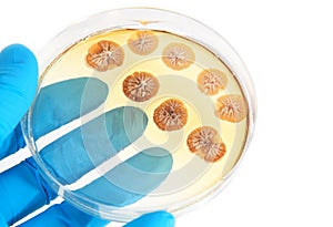 Fungi microorganisms on agar plate in laboratory