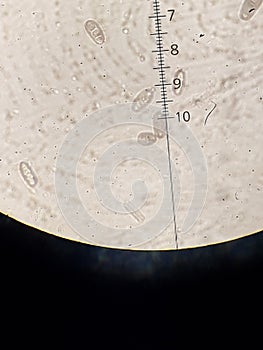 Fungi spores under light microscopy