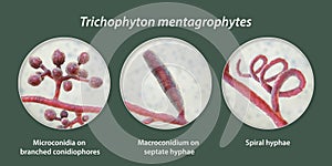Fungi Trichophyton mentagrophytes, 3D illustration