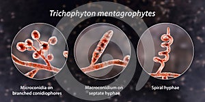 Fungi Trichophyton mentagrophytes, 3D illustration