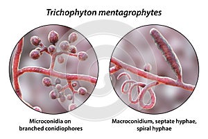 Fungi Trichophyton mentagrophytes, 3D illustration photo