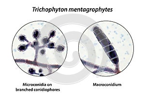 Fungi Trichophyton mentagrophytes, 3D illustration photo
