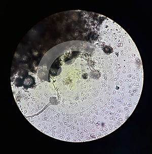 Fungi under microscopic view Aspergillus. Fungus microbiology