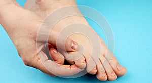 Fungus of foot close-up, on blue background. The concept dermatology, treatment fungal and fungal infections in humans.