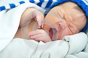 Funny baby face in hat,newborn with jaundice on white blanket, infant healthcare