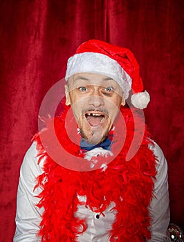 Funny happy smiling toothless man wearing Santa hat big fat bruise under his eye. New Year style