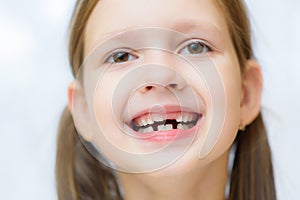 Funny toothless girl laughing with his mouth open