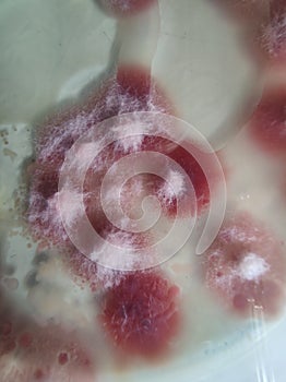 Fusarium fungal colonies on sabouraud dextrose agar medium