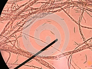 Fusarium sp. Pathogen of rice