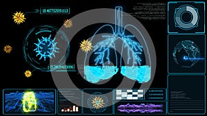 Futuristic monitor of Pulmonary Edema is a condition caused by abnormal fluid in the alveoli