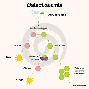 galactosemia vector illustration diagram